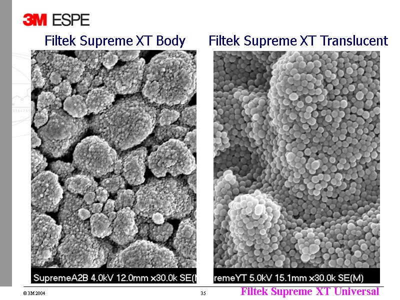 Filtek Supreme XT Body Filtek Supreme XT Translucent Filtek Supreme XT Body Filtek Supreme XT Translucent